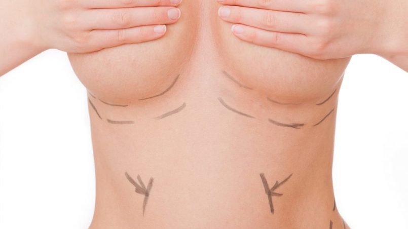 © detailblick-foto - fotolia
